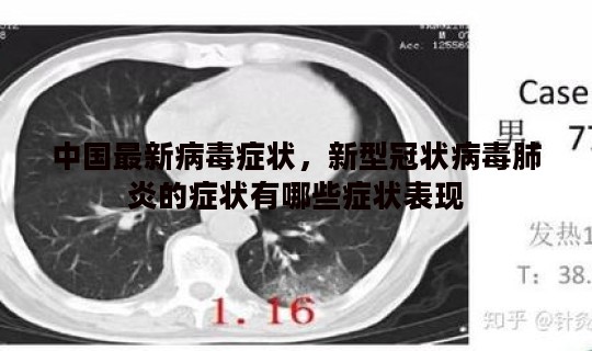 中国最新病毒症状，新型冠状病毒肺炎的症状有哪些症状表现