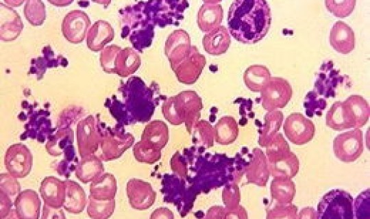 apv病毒 apv是什么意思