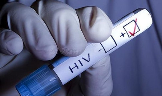 长沙阳性感染者(hiv阳性)