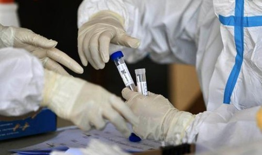 北京入职3天内核酸检测 核酸检测hiv