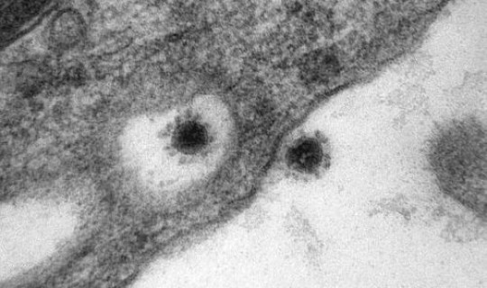 德尔塔变异毒株会出现哪些症状 新冠delta变异毒株的特点