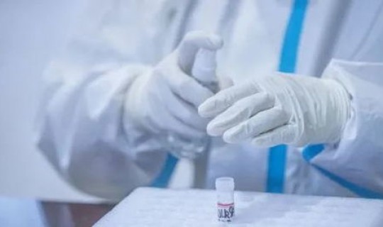 大连核酸检测阳性 核酸是什么