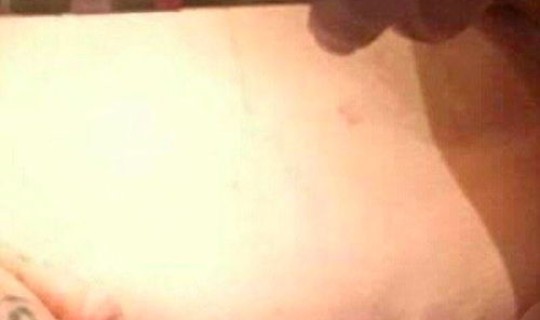 哈尔滨发现3例，哈尔滨最近病毒感冒