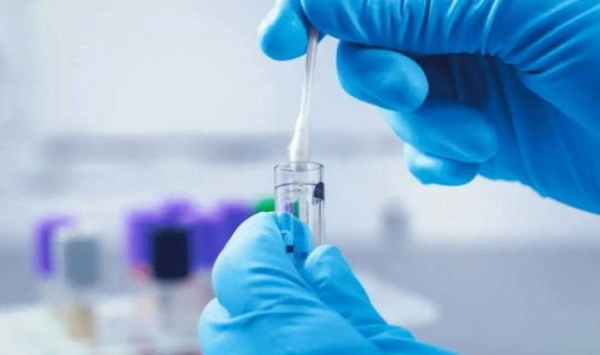 哪些人需要隔离7天核酸检测 核酸检测hiv有没有意义