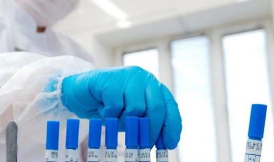 现在坐火车要核酸检测吗？(核酸检测hiv有没有意义)