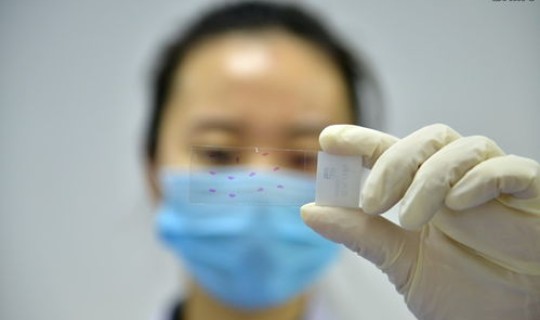 北京现在核酸 现在北京要核酸检测吗 北京现在核酸 现在北京要核酸检测吗