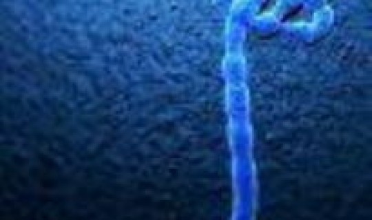 大连的病毒情况(埃博拉病毒)