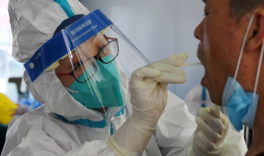 28号当日返乡需要核酸检测吗(核酸检测hiv有没有意义)