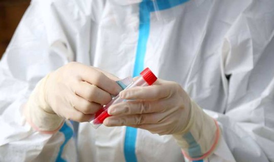 核酸检测志愿者感染？新冠核酸检测能查出艾滋病吗