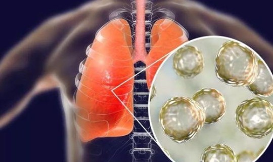 常州感染新型肺炎？新型肺炎的最新情况