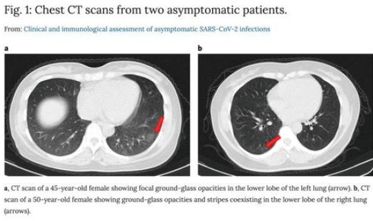 核酸检测ct值多少正常 甲流ct值多少属于正常