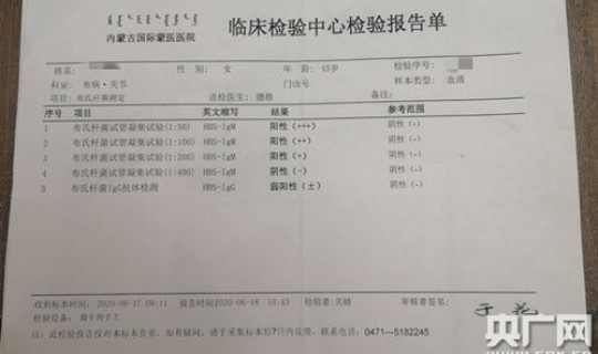 安徽确诊首例肺炎，安徽最近病毒传染