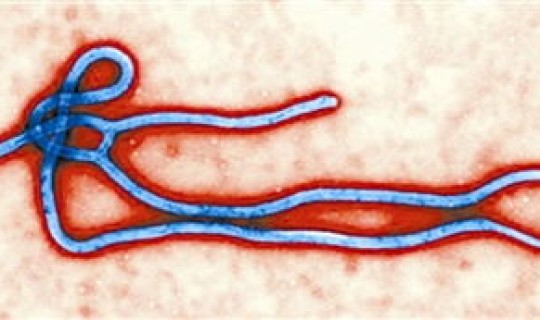 郑州新增病毒？埃博拉病毒