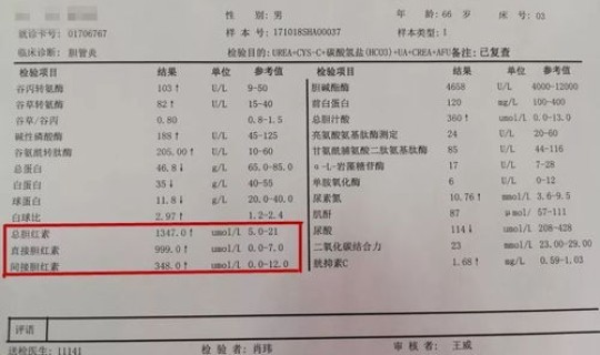 陕西西安确诊病例最新消息今天？西安市狂犬病例