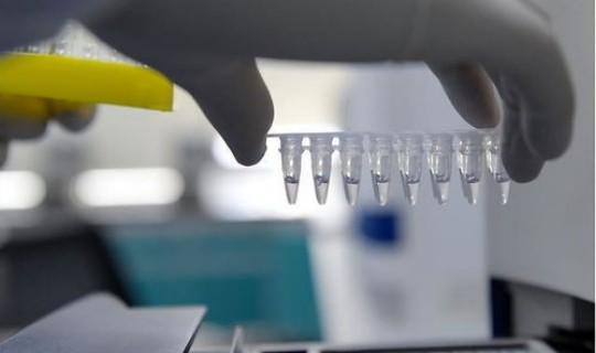 上海需要核酸检测吗 核酸检测是自费还是免费