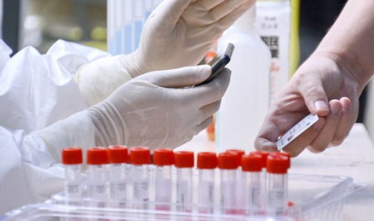 多地优化核酸检测要求最新消息？hiv核酸检测准确率