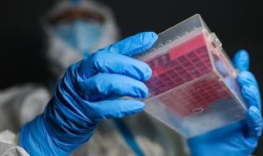 广东本土确诊无症状感染者(艾滋病病毒感染者是指)