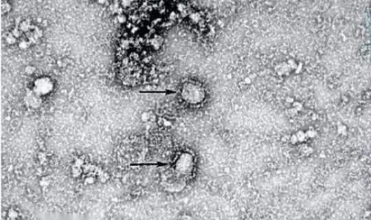 额济纳旗新冠病毒最新消息今天(上海新型冠状病毒)