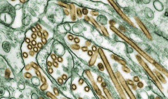 最新疫情病毒情况 禽流感病毒