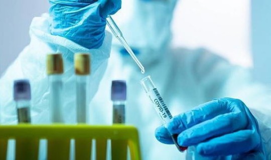 东莞不出省需要做核酸吗今天 8月份去东莞要做核酸检测吗