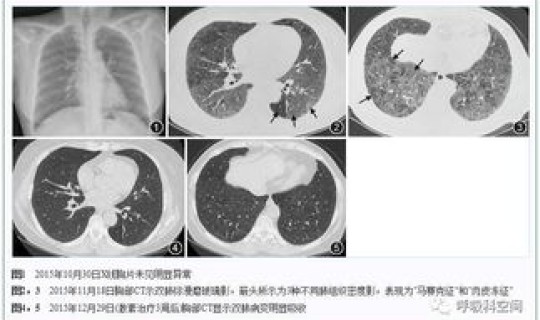 核酸检测结果分不分男女？hiv核酸检测