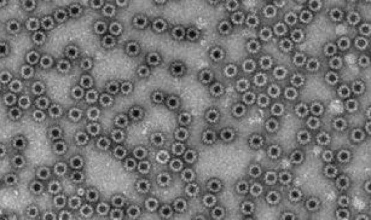 德尔塔病毒在上海?诺如病毒 德尔塔病毒在上海?诺如病毒