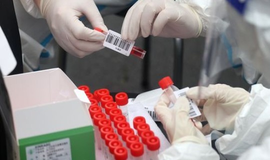 四川新增无症状感染者2例是哪里的 四川无症状感染者疫情最新消息