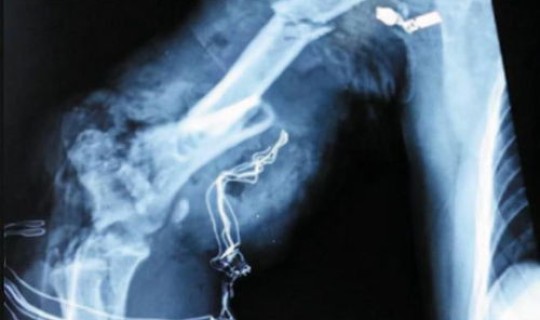 上海最近意外3人死亡原因？意外死亡的原因