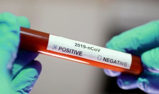 江苏常州检测阳性，新冠阳性怎么检测