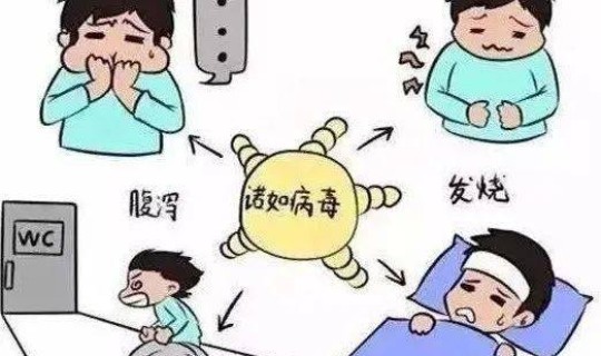 成都几列病毒，诺如病毒