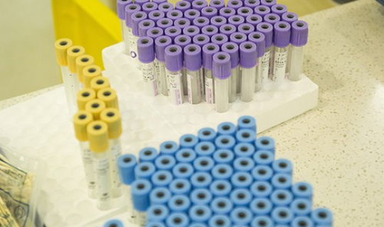 宁津新冠肺炎最新情况通报(2020新冠肺炎死亡总人数)