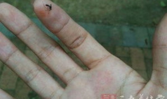 广州 感染(广州最近流行传染疾病) 广州 感染(广州最近流行传染疾病)