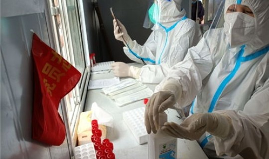 江西核酸检测一次间隔几天做一次，hiv核酸检测准确率