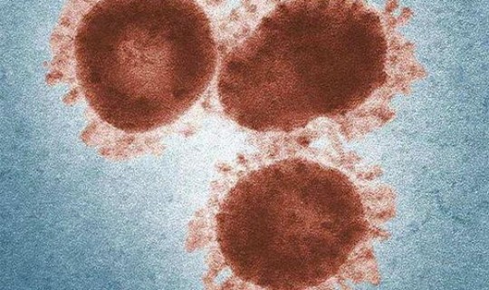 天水市新冠肺炎最新情况？ 冠状病毒肺炎