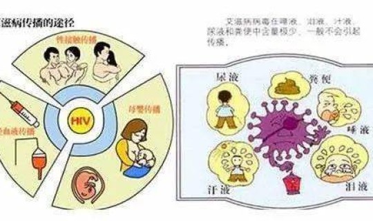 成都出现无症状感染者 艾滋病病毒感染者是指