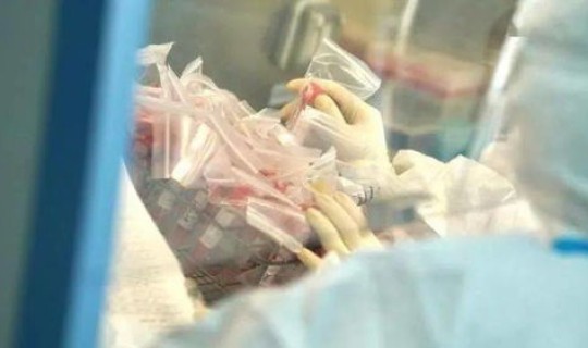 密切接触者核酸为阴性 b族链球菌核酸检测阴性