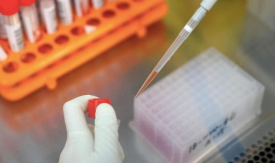 常态化核酸检测管理办法最新，病毒核酸检测