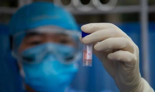 无症状感染者增长？艾滋病携带者症状