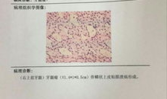 19号四川新增病例多少？四川有传染病发是真吗