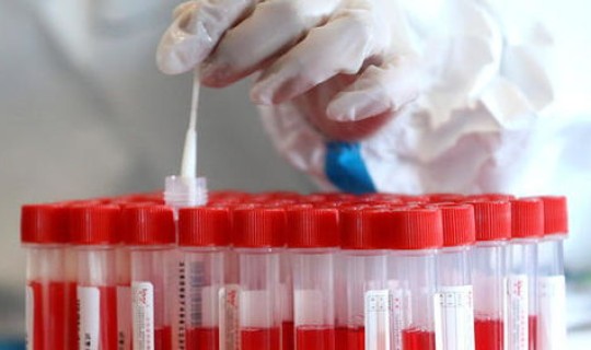 北京核酸检测混合检测？北京核酸是不是都是混合检测