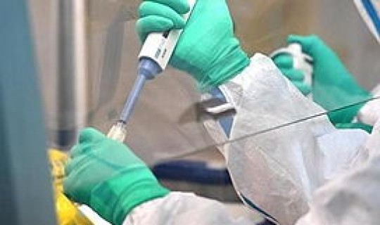 青岛无症状感染者详情 艾滋病病毒感染者是指