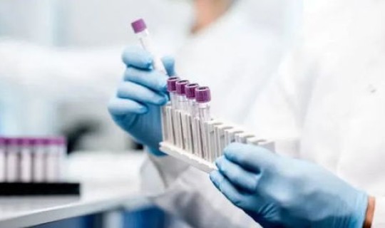 上海疫情现在咋样了(上海现在疫情情况怎么样)