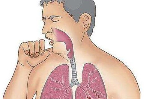 永康有新型肺炎吗 肺炎的自我判断