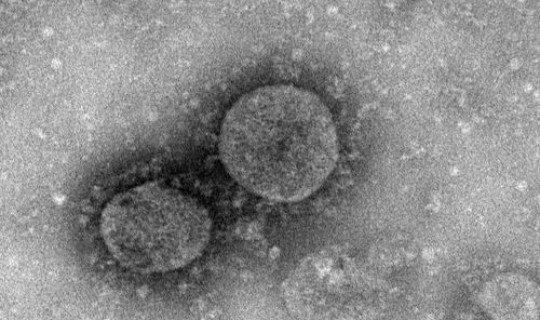 新型冠状病毒谁是第一个病毒？新型冠状病毒属于什么病毒