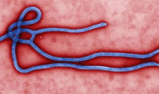 日本病毒扩散的原因 新型病毒的症状是怎样的？