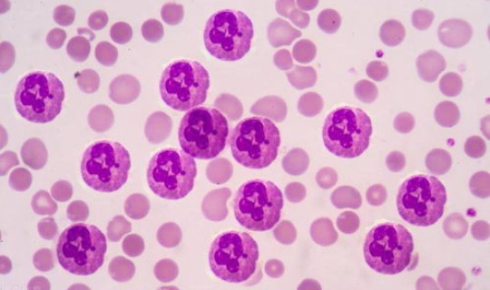 混合性细胞(红细胞位相混合型)