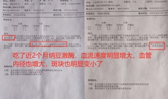 黑龙江新增4例确诊病例活动轨迹	，黑龙江多少艾滋病患者