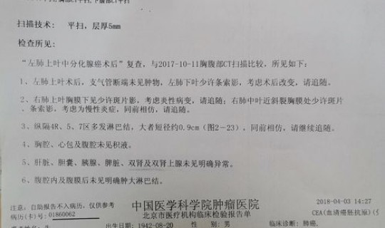 青岛出现一例无症状新冠病例？青岛病例最新消息今天