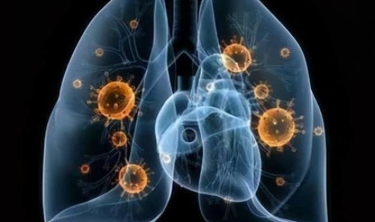 新冠肺炎日本死了多少人(日本新冠肺炎最新情况)