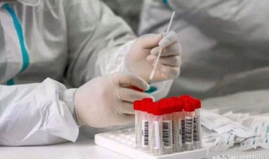福田 核酸检测 核酸检测为什么不能排除hiv